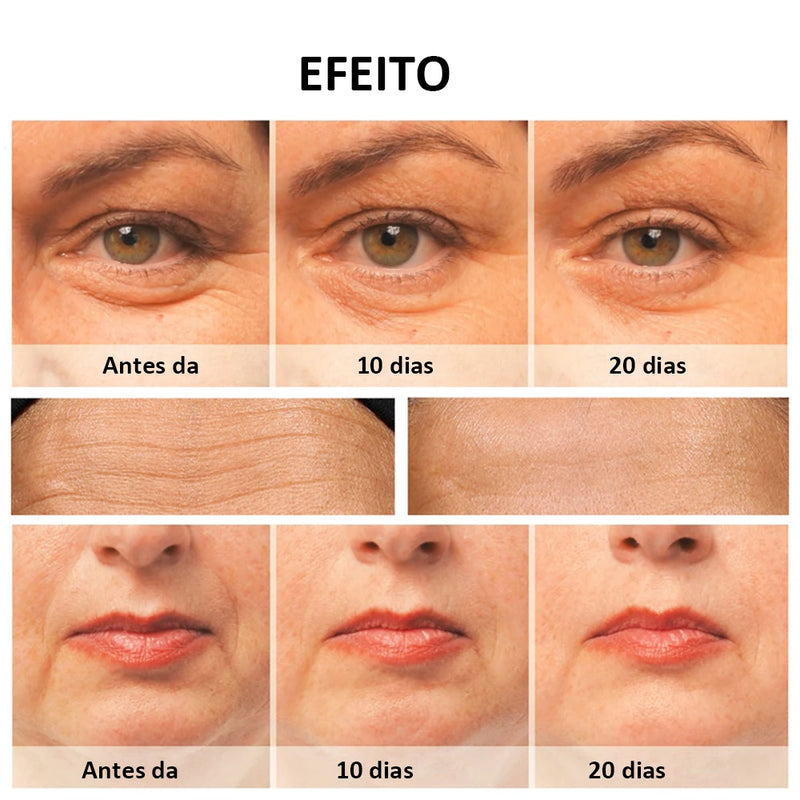 Facial Massager RF Facial Radiofrequency High Frequency Face Lifting Machine EMS Facial Microcurrent Lift Skin Tightening Device